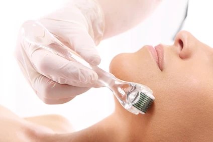 Mesotherapy for Face: Benefits and Treatment Overview